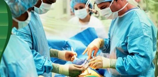 Operation