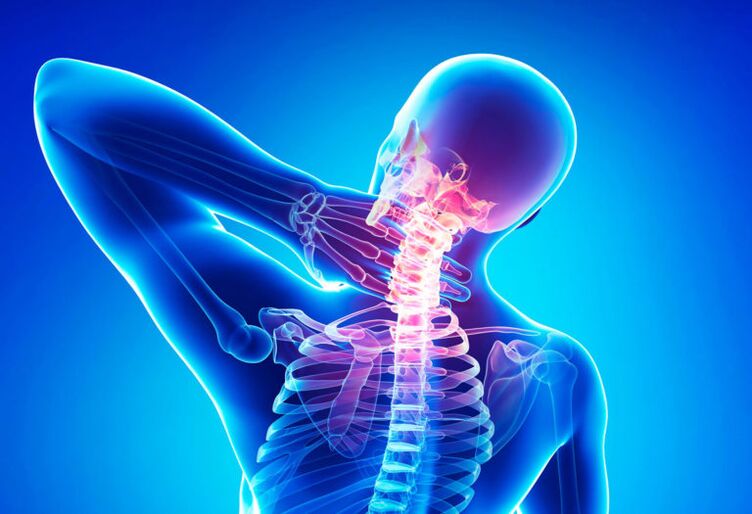 Osteochondrose der Halsspalte