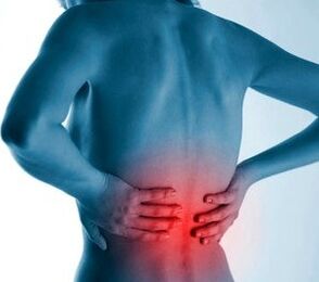 lumbale Osteochondrose