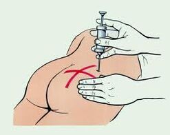 Injektion zur Behandlung von Osteochondrose